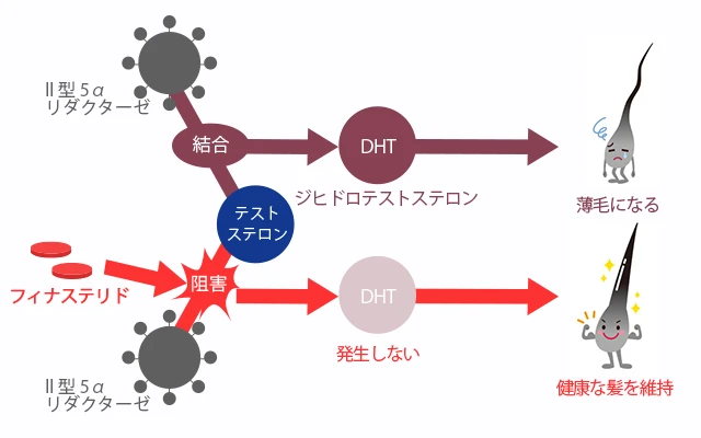 フィナステリドの作用